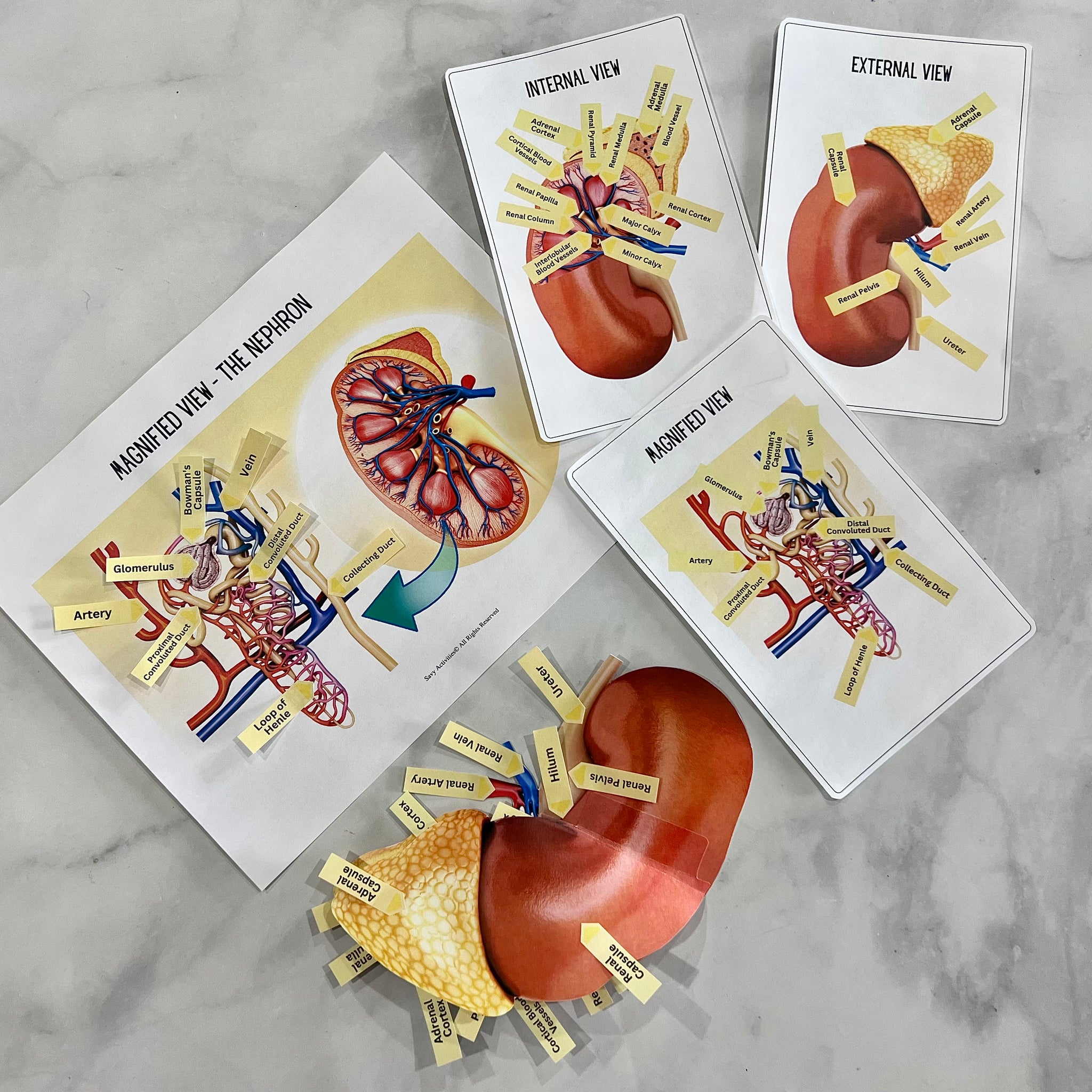 Anatomy HUMAN KIDNEY - Full Color Anatomically Correct 2D Dissection A ...